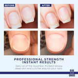 Cuticle Remover Liquid - 8oz