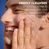 Nivea Derma Skin Clear Acne Facial Cleanser 150ml | Deep Clean
