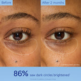 Caudalie Vinoperfect Brightening Eye Cream - Dark Circle Treatment & Anti-aging Eye Care