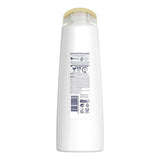 Dove Ultra Care Aloe Vera Anti-Dandruff Shampoo: Soothe Itchy, Dry Scalp & Eliminate Flakes with Natural Tea Tree Oil - Vegan & Paraben Free