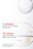 Avene Cleanance Comedomed Peeling 40 ml - Gentle Exfoliating Solution for Acne-Prone Skin