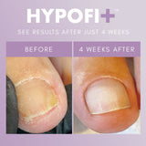 HypoFix™ Primer - 20ml