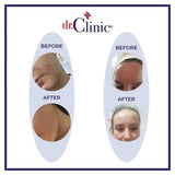 Dr.Clinic Vitamin C Facial Day Serum | Anti Aging, Fine Lines, Eye Wrinkle Skin Repair with Hyaluronic Acid | Moisturizer and Pore Cleanser | Protects from Acne Scars, Sun Damage, 1.01 fl.Oz.