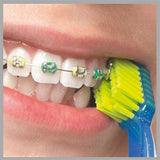 Curaprox CS 5460 Orthodontic Toothbrush - Gentle, Effective Oral Care for Braces & Orthodontic Appliances