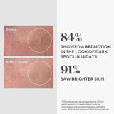 DR.Murad Dark Spot Correcting Serum - Rapidly Reduces Hyperpigmentation, Evens Skin Tone, 30ml