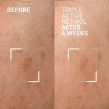 Dr. Brandt Triple Active Retinol Anti-Wrinkle Treatment 30g